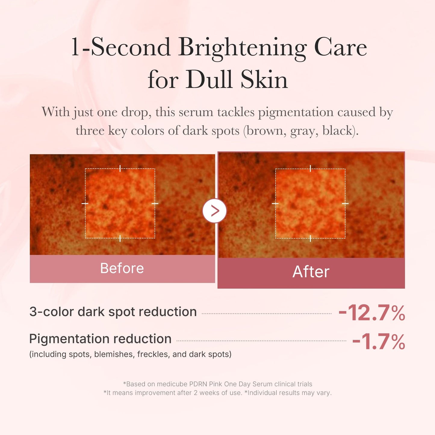 (NEW) PDRN Pink One Day Serum