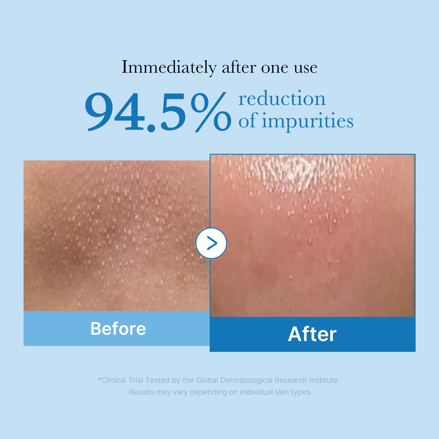 (NEW) Zero Pore Blackhead Deep Cleansing Oil