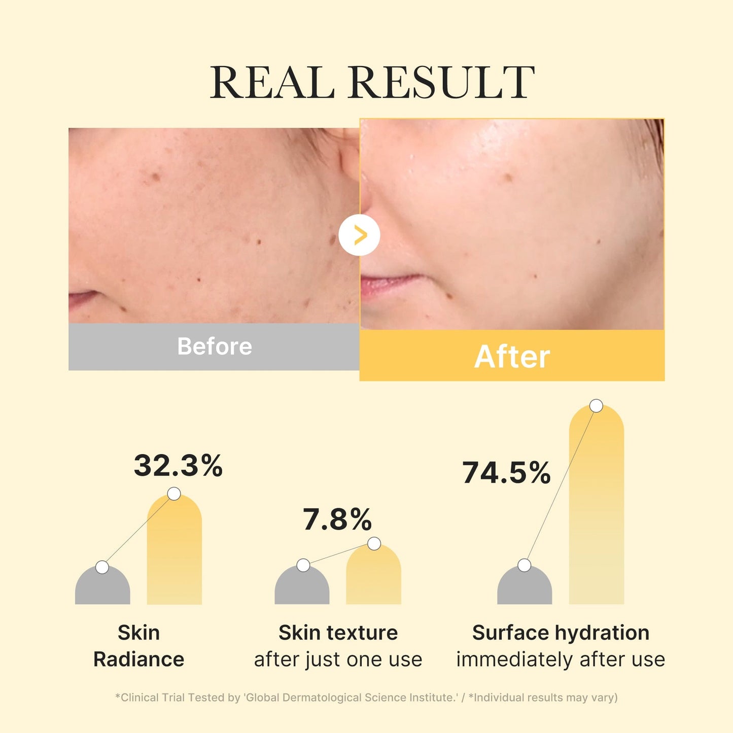 (NEW) Kojic Acid Turmeric Brightening Gel Mask – MEDICUBE MY