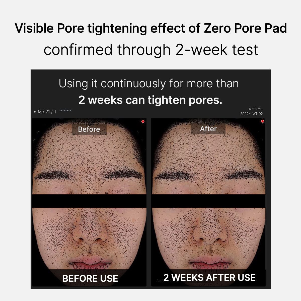 [New][Official Store Only] Zero Pore Pad 2.0 Refill Set (70ea+70ea)