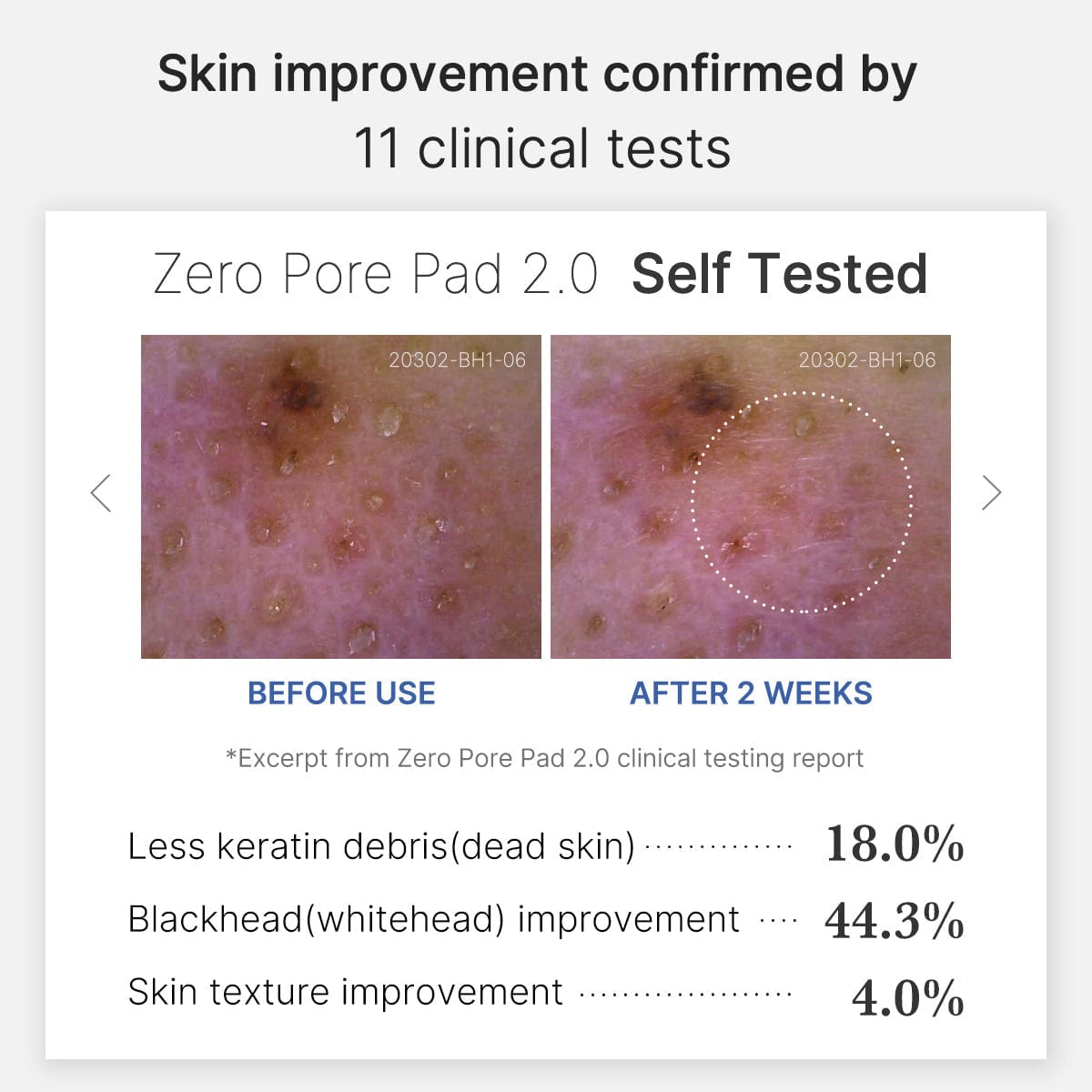 [New][Official Store Only] Zero Pore Pad 2.0 Refill Set (70ea+70ea)