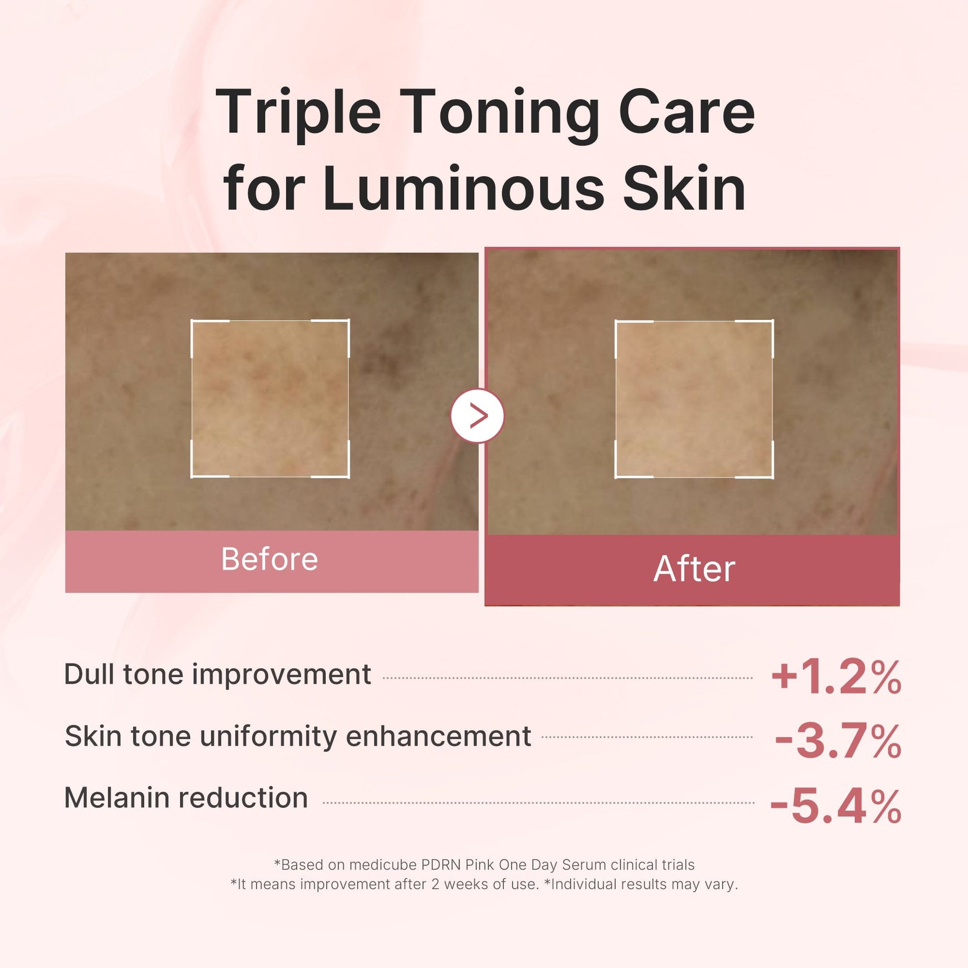 (NEW) PDRN Pink One Day Serum