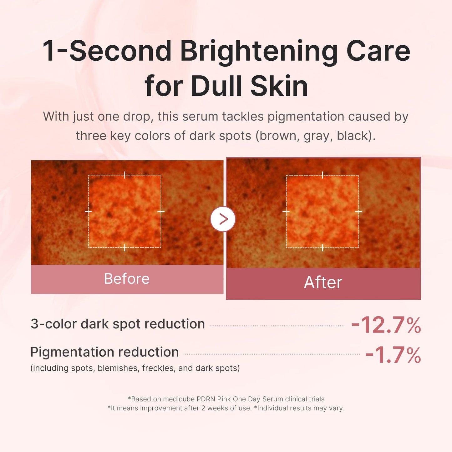 (NEW) PDRN Pink One Day Serum