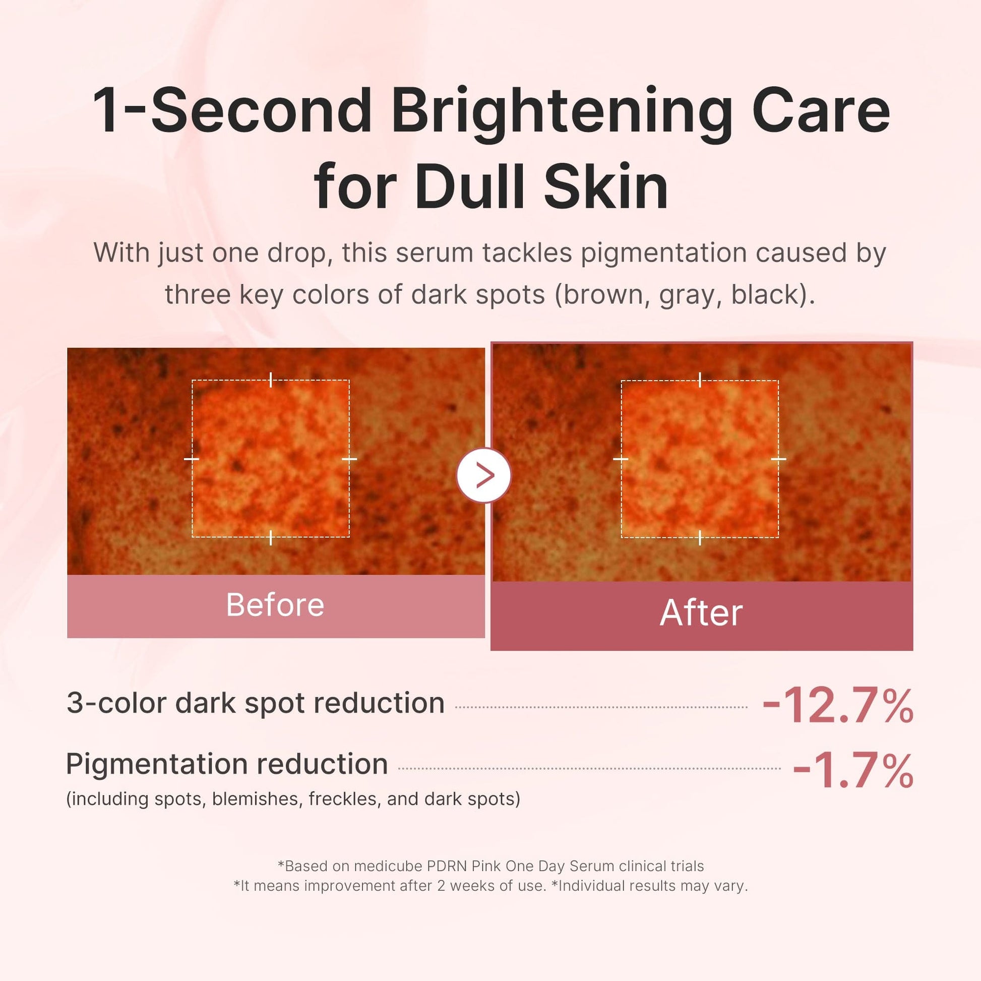 (NEW) PDRN Pink One Day Serum