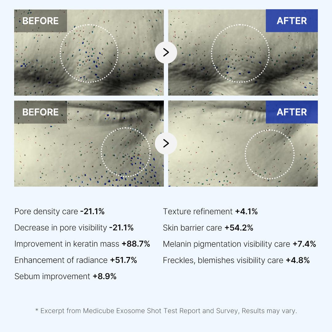 One Day Pore Shot 2000/7500 Microneedling Serum