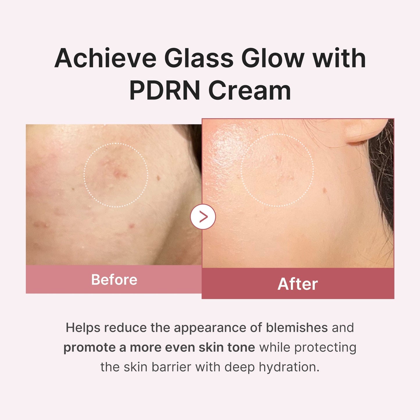 PDRN Pink Hyaluronic Moisturizing Cream