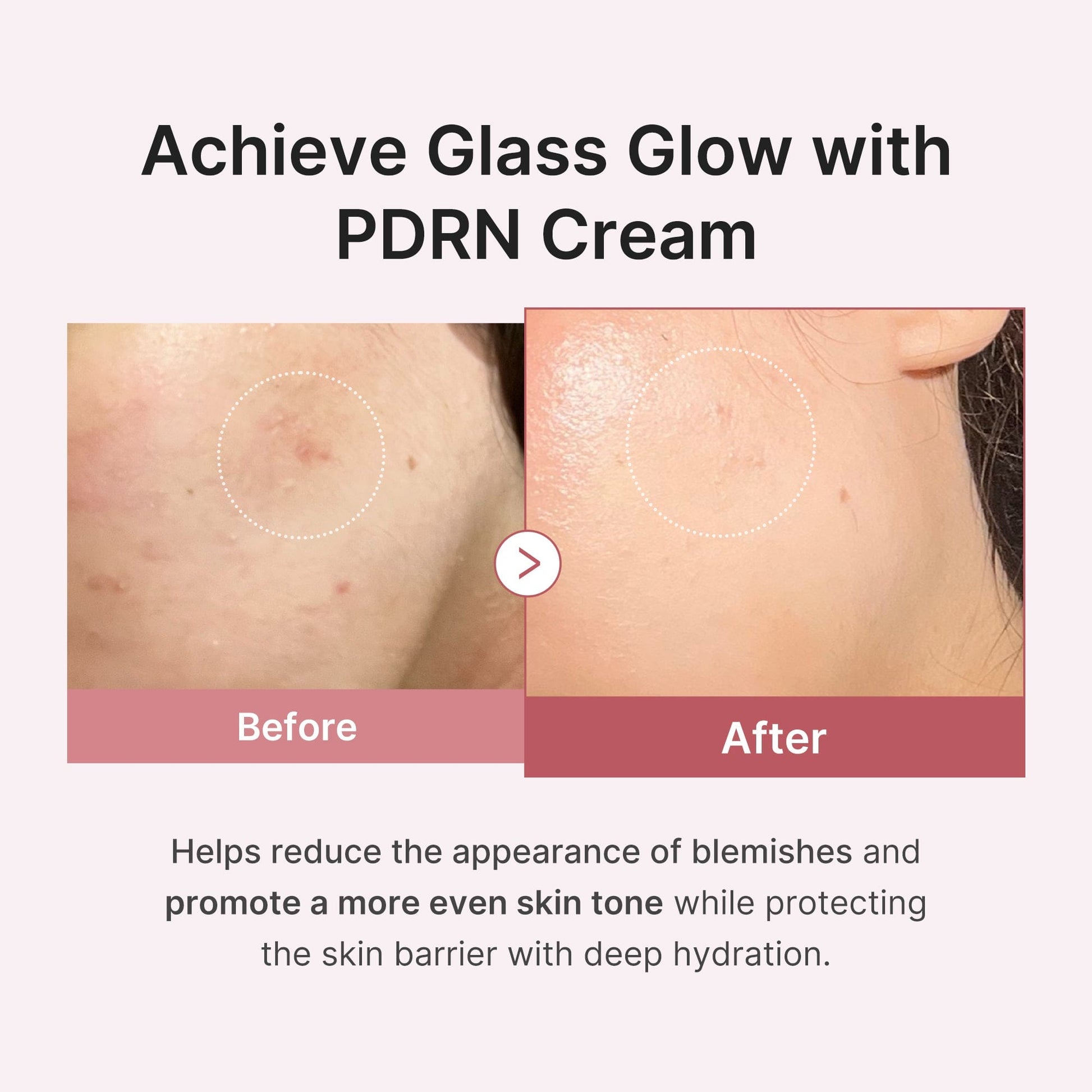 PDRN Pink Hyaluronic Moisturizing Cream