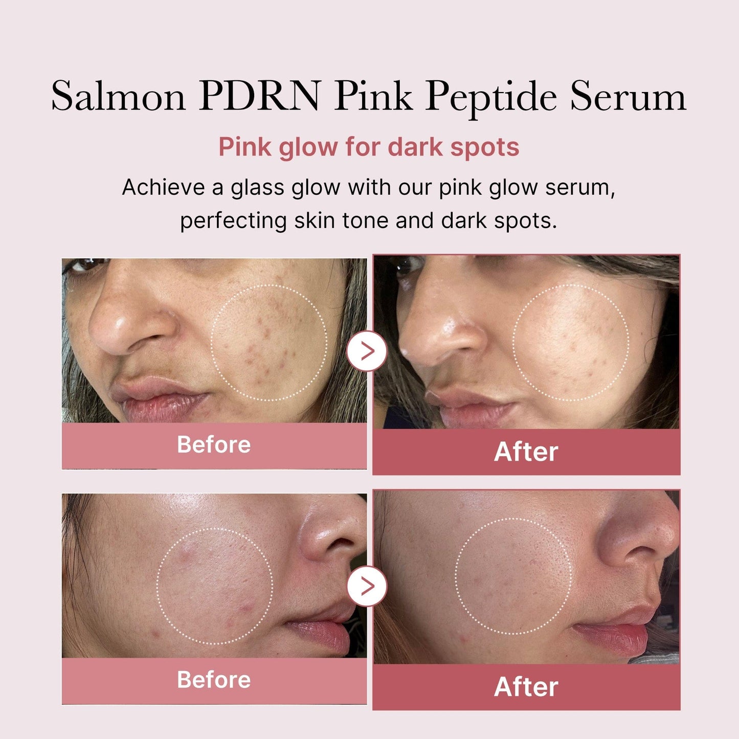 PDRN Pink Peptide Brightening Glow Serum