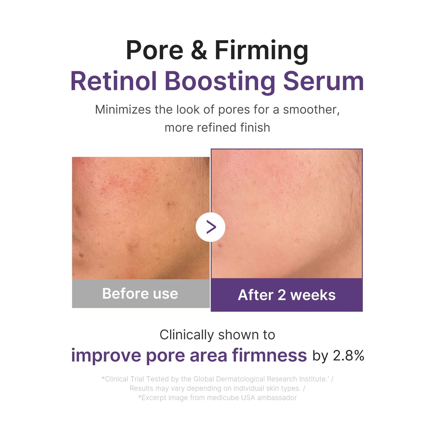 Retinol NMN Boosting Serum