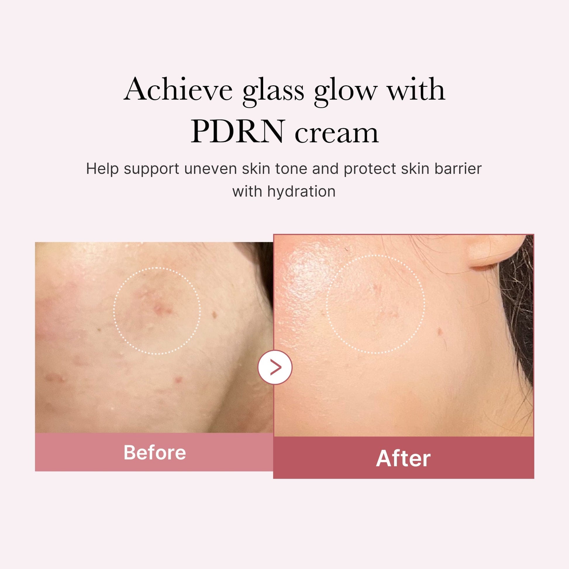 [Shipping from 29/11] PDRN Pink Hyaluronic Moisturizing Cream