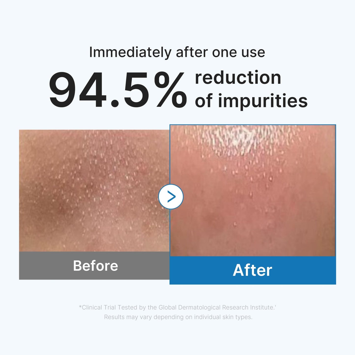 Zero Pore Blackhead Deep Cleansing Oil