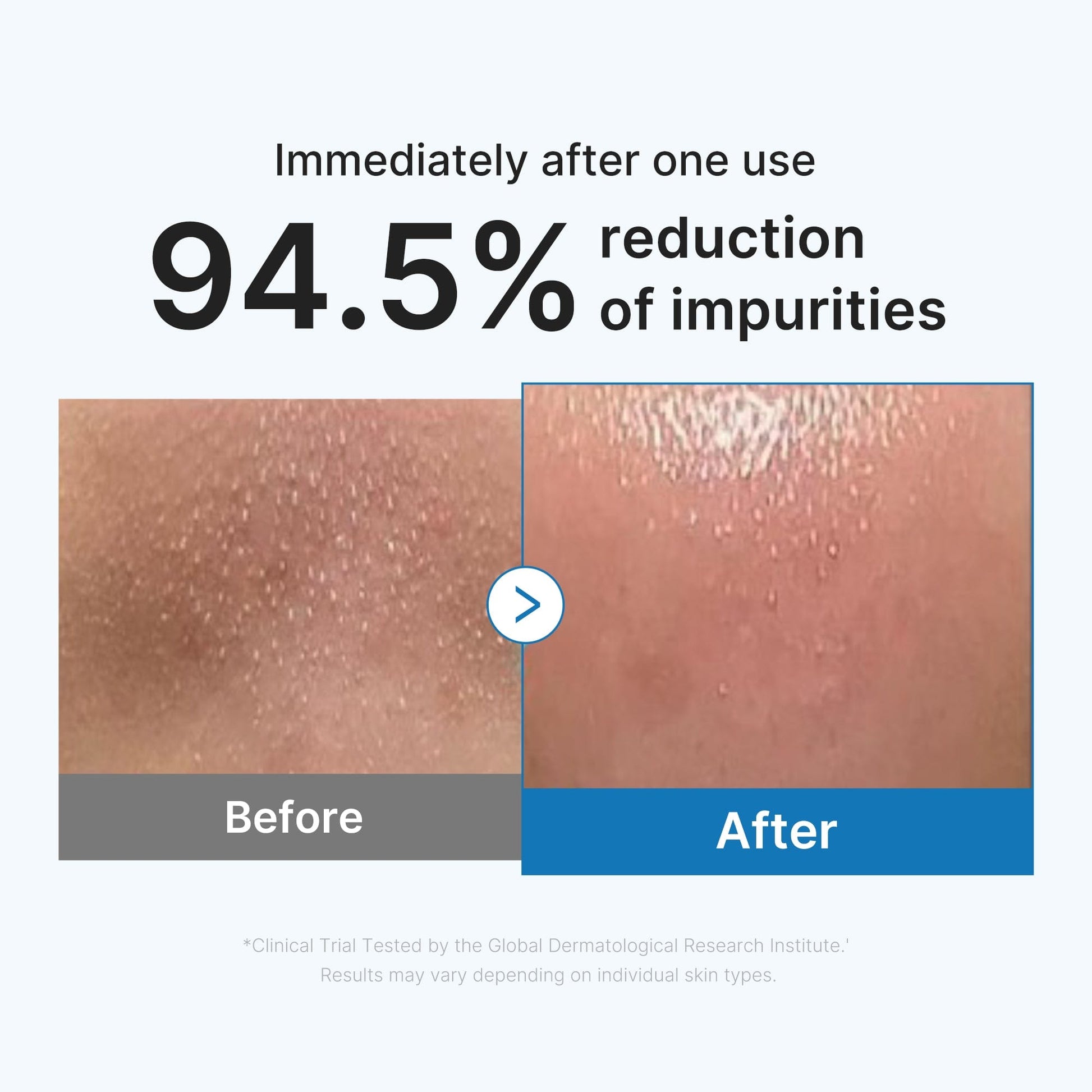 Zero Pore Blackhead Deep Cleansing Oil