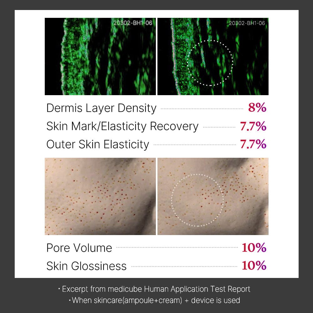 [Collagen Stimulation] Age-R Ussera Deep Shot